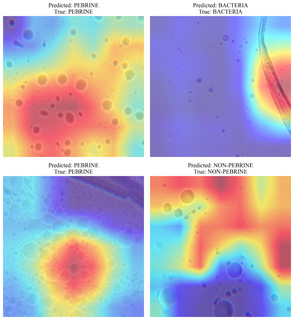 Grad-CAM model explanation panels from SeriScope testing