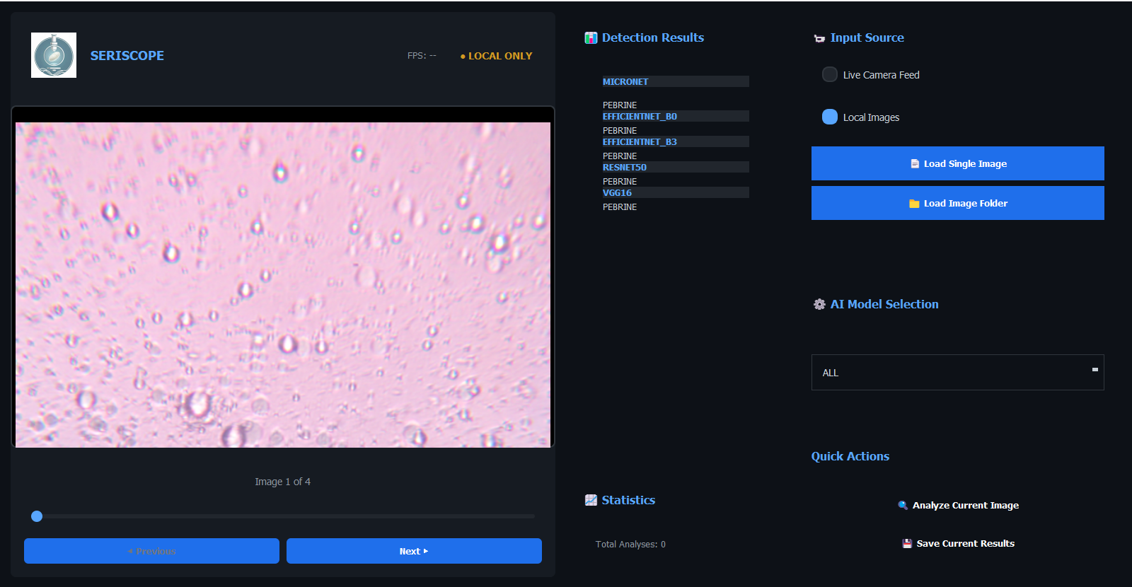 SeriScope diagnostic interface showing model results